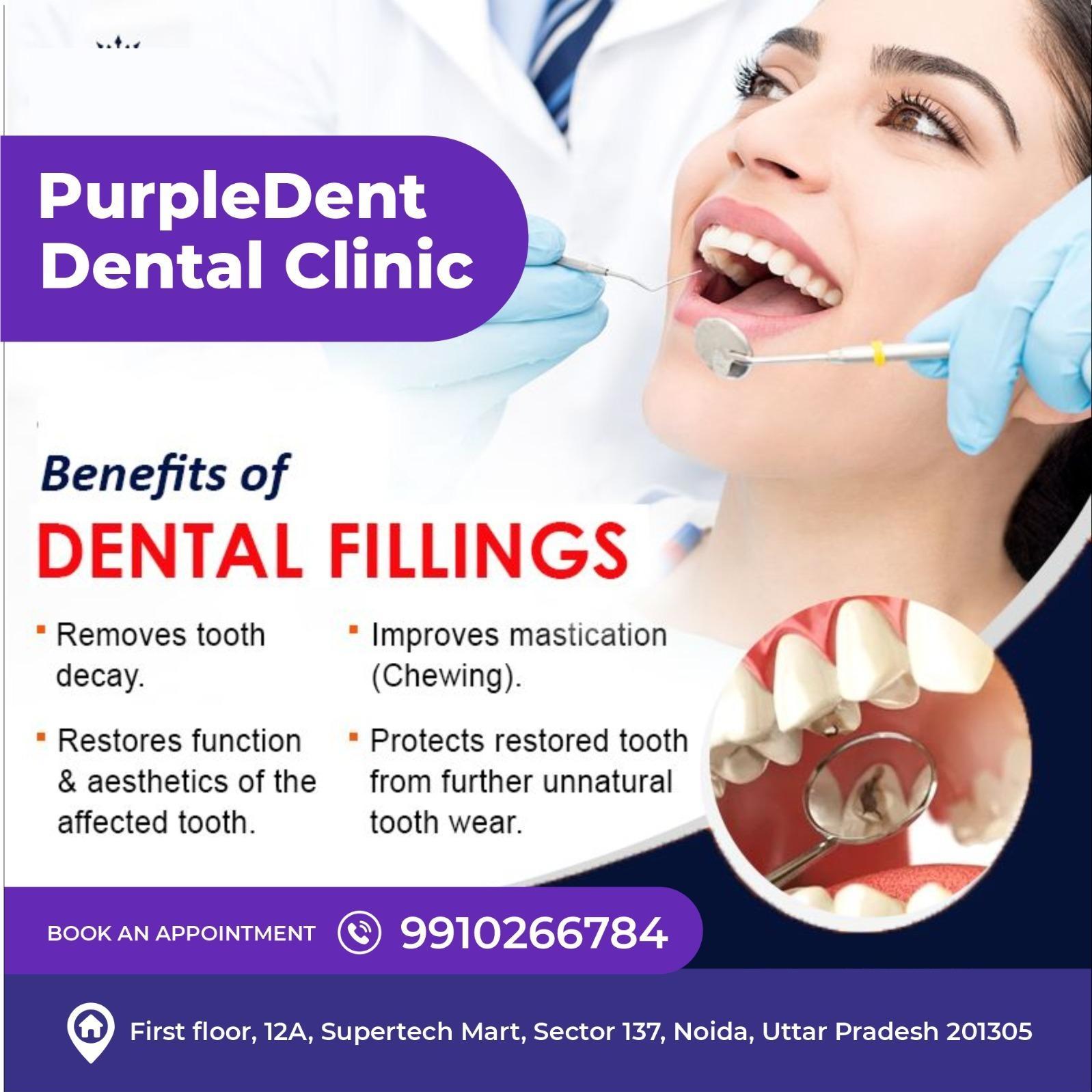 PurpleDent01